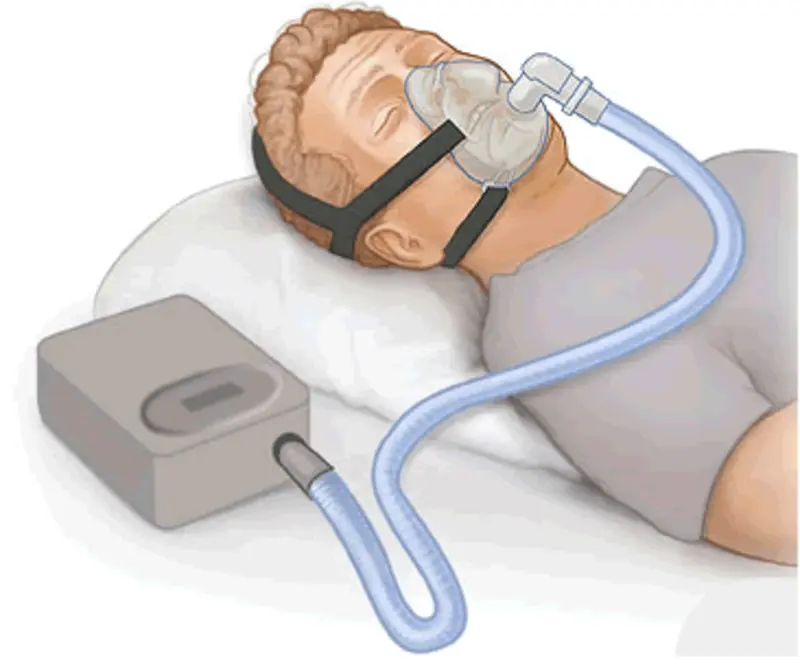 CPAP چیست